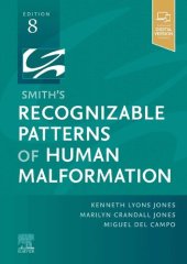 book Smith's Recognizable Patterns of Human Malformation: Expert Consult - Online and Print