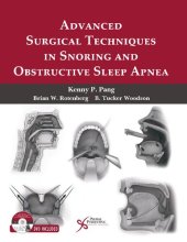 book Advanced Surgical Techniques in Snoring and Obstructive Sleep Apnea