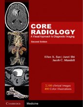 book Core radiology : A Visual Approach To Diagnostic Imaging