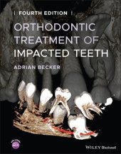 book Orthodontic Treatment of Impacted Teeth