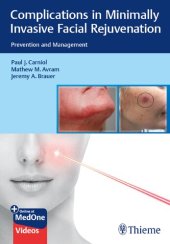 book Complications in Minimally Invasive Facial Rejuvenation: Prevention and Management