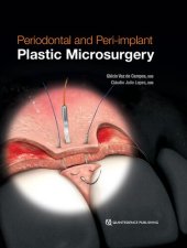 book Periodontal and Peri-implant Plastic Microsurgery: Minimally Invasive Techniques with Maximum Precision