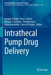 book Intrathecal Pump Drug Delivery