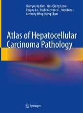 book Atlas of Hepatocellular Carcinoma Pathology