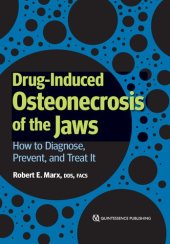 book Drug-Induced Osteonecrosis of the Jaws: How to Diagnose, Prevent, and Treat It