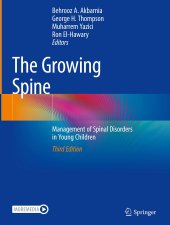 book The Growing Spine: Management of Spinal Disorders in Young Children