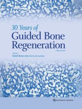 book 30 Years of Guided Bone Regeneration