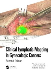 book Clinical Lymphatic Mapping in Gynecologic Cancers