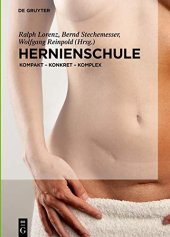 book Hernienschule: Kompakt - Konkret - Komplex (German Edition)