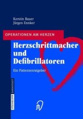 book Herzschrittmacher und Defibrillatoren: Ein Patientenratgeber (Operationen am Herzen) 