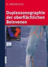 book Duplexsonographie der oberflächlichen Beinvenen