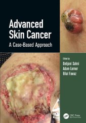 book Advanced Skin Cancer: A Case-Based Approach