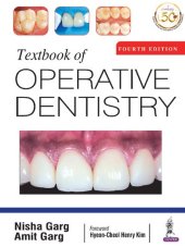 book Textbook of operative dentistry