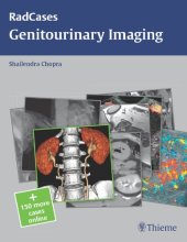 book Radcases Genitourinary Imaging (Radcases Plus Q&A)