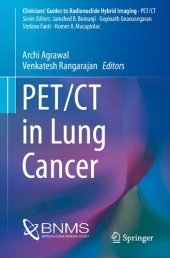 book PET/CT in Lung Cancer (Clinicians’ Guides to Radionuclide Hybrid Imaging)