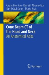 book Cone Beam CT of the Head and Neck: An Anatomical Atlas