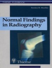 book Normal Findings in Radiography