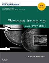 book Breast Imaging: Case Review Series