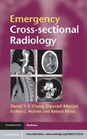 book Emergency Cross-sectional Radiology (Cambridge Medicine (Paperback))