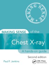 book Making Sense of the Chest X-ray: A hands-on guide