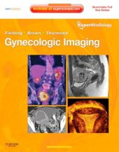 book Gynecologic Imaging: Expert Radiology Series (Expert Consult Premium Edition - Enhanced Online Features and Print), 1e