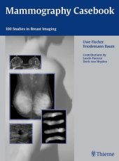 book Mammography Casebook: 100 Studies in Breast Imaging