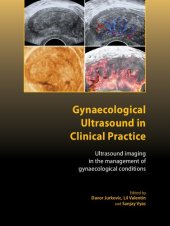 book Gynaecological Ultrasound in Clinical Practice: Ultrasound Imaging in the Management of Gynaecological Conditions (Royal College of Obstetricians and Gynaecologists Advanced Skills)