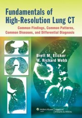 book Fundamentals of High-Resolution Lung CT: Common Findings, Common Patters, Common Diseases and Differential Diagnosis: Common Findings, Common Patterns, Common Diseases, and Differential Diagnosis