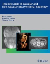 book Teaching Atlas of Vascular and Non-vascular Interventional Radiology