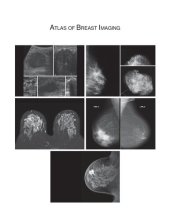 book Atlas of Breast Imaging with Mammography, Ultrasound and MRI Correlation