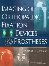 book Imaging of Orthopaedic Fixation Devices and Prostheses