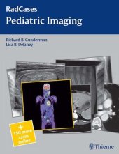 book Pediatric Imaging (Radcases Plus Q&A)