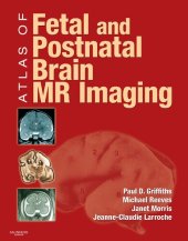 book Atlas of Fetal and Postnatal Brain MR