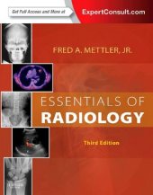 book Essentials of Radiology: Common Indications and Interpretation (Mettler, Essentials of Radiology)