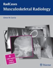 book Musculoskeletal Radiology (Radcases Plus Q&A)