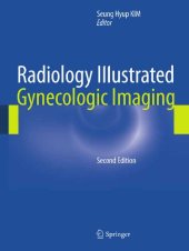 book Radiology Illustrated: Gynecologic Imaging