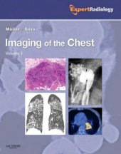 book Imaging of the Chest, 2-Volume Set: Expert Radiology Series, 1e