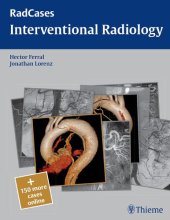 book Interventional Radiology (Radcases Plus Q&A)