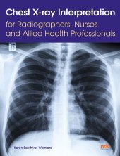 book Chest X-ray Interpretation for Radiographers, Nurses and Allied Health Professionals