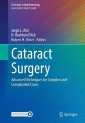 book Cataract Surgery: Advanced Techniques for Complex and Complicated Cases (Essentials in Ophthalmology)