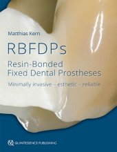 book RBFDPs : resin-bonded fixed dental prostheses : minimally invasive, esthetic, reliable