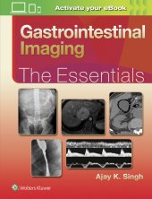 book Gastrointestinal Imaging: The Essentials (Essentials Series)