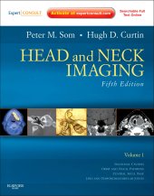 book Head and Neck Imaging (Expert Consult)