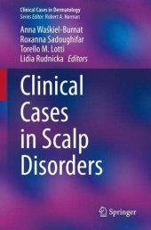 book Clinical Cases in Scalp Disorders