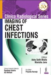 book Clinico Radiological Series: Imaging of Chest Infections