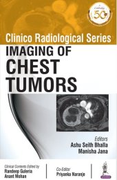 book Clinico Radiological Series: Imaging Of Chest Tumors