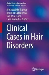 book Clinical Cases in Hair Disorders