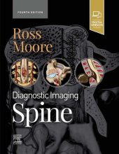 book Diagnostic Imaging: Spine