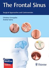 book The Frontal Sinus: Surgical Approaches and Controversies