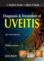 book Diagnosis and Treatment of Uveitis